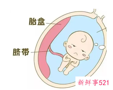 轻微漏羊水的症状