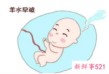 臀位破水来得及吗