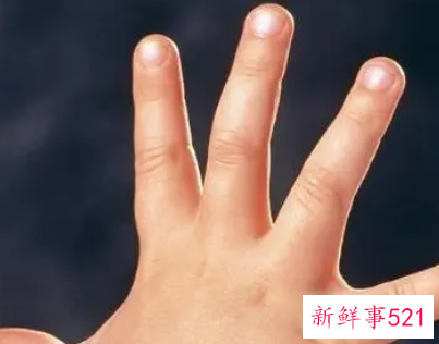 15岁孩子总咬手是什么原因