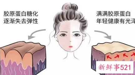 有没有快速去皱的方法