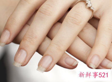 手指甲有月牙好还是没有月牙好