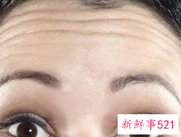 年龄很小为什么会脸部松弛