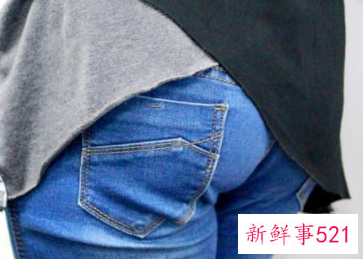 女性肛门痒看什么科