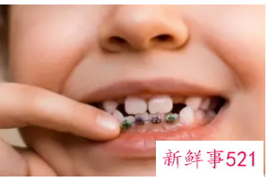 牙齿保养方法有哪些