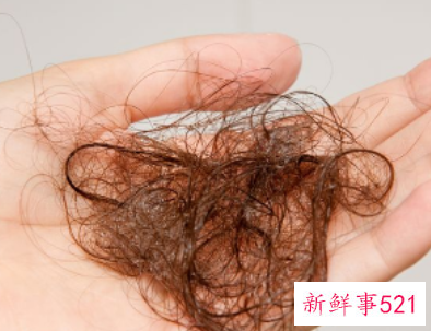 身体脱毛是怎么回事