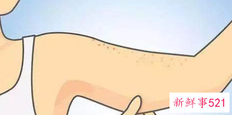 如何去腿上的鸡皮肤