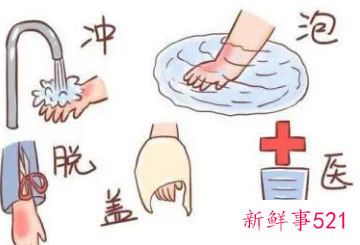 烫伤后离了凉水特别疼怎么缓解