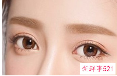 内双眼皮和外双眼皮的区别是什么