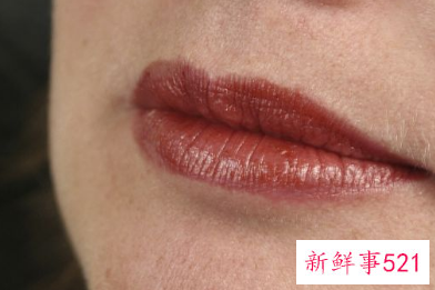 嘴角起泡怎样痊愈最快