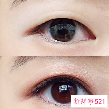 内双眼皮和外双眼皮的区别是什么