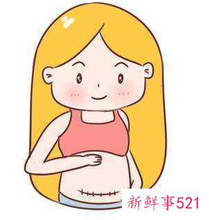 产力不足只能剖腹产