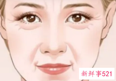 法令纹自己怎么改善