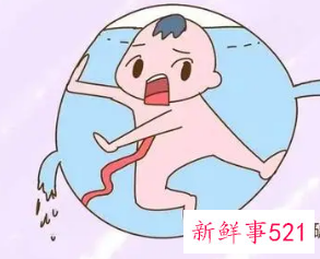 臀位破水来得及吗