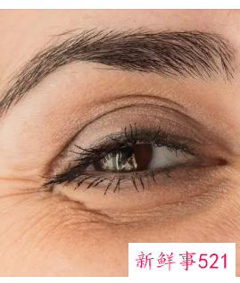 眼睛边上的皱纹怎么保养