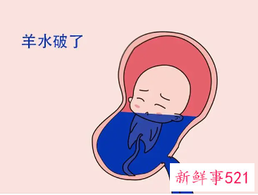 轻微漏羊水的症状