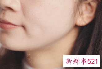 冬季皮肤干燥像蛇皮的原因