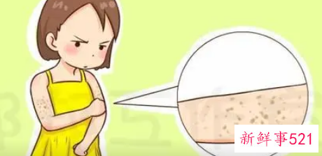 如何去腿上的鸡皮肤