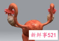 妇科病怎么治才能根除