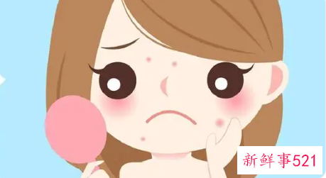 额头两侧起痘痘的原因是什么