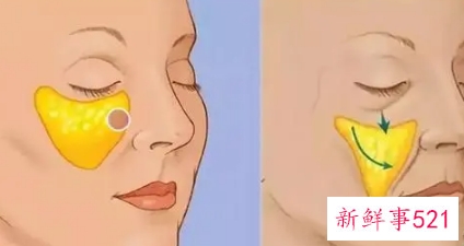 如何延缓面部下垂