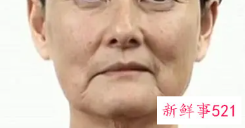 年龄很小为什么会脸部松弛