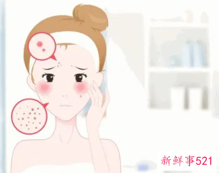 怎么改善油性皮肤体质