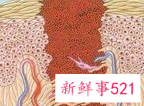 哪些人建议补充维生素C呢