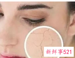 怎么判断皮肤水油平衡