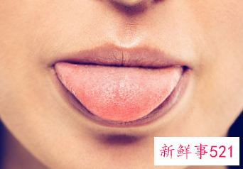 嘴角起泡怎样痊愈最快