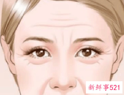 怎么改善额头的皱纹