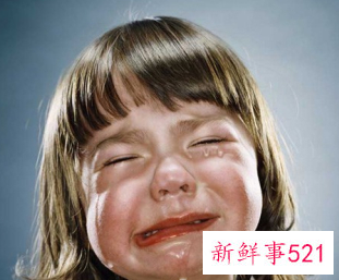 面部无光泽是什么原因