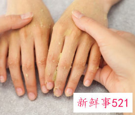 如何使手部皮肤白嫩