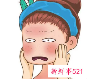 怎样改善脸上红血丝小妙招