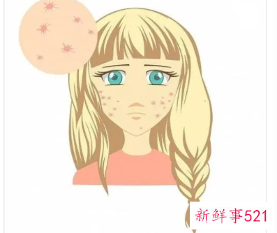 怎样可以淡化痘痘印