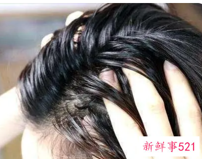 洗头时候掉很多头发是什么原因