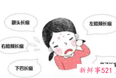 内分泌失调老长痘痘咋排毒