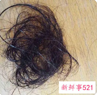 洗头时候掉很多头发是什么原因