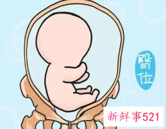 胎儿24周臀位孕妇少坐