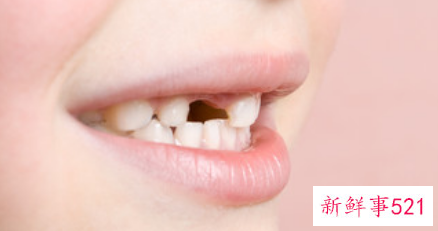 已婚女人梦见掉牙