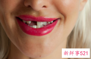 已婚女人梦见掉牙