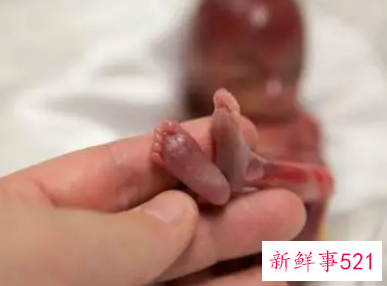 八个月早产儿能存活吗