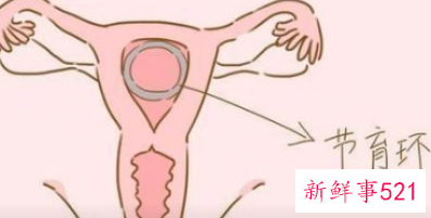 取环疼吗大概要几分钟