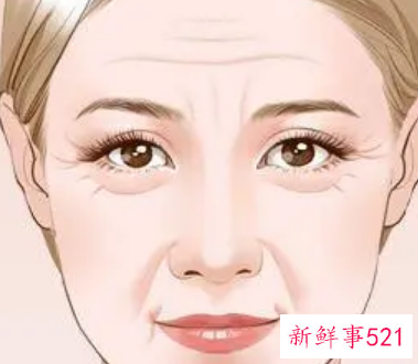 怎么会产生法令纹