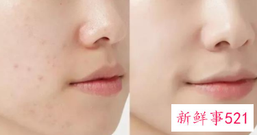 干燥季节的护肤洁面技巧