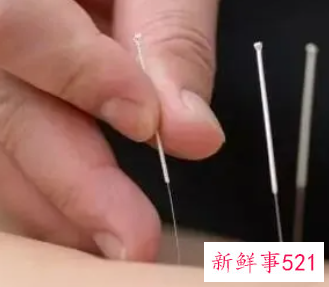针灸为什么不能下午扎