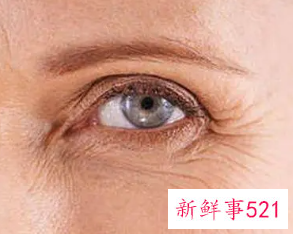 怎么保养眼睛不长皱纹