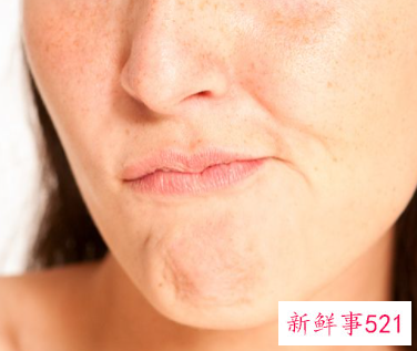 为什么脸上又红又痒反复发作