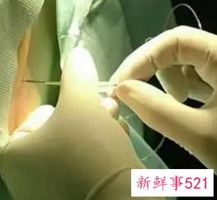 丰体针丰胸有什么副作用