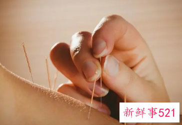 针灸为什么不能下午扎