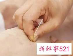 针灸科个人小结